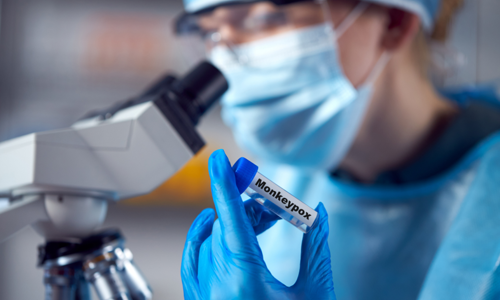 MPOX Image 1