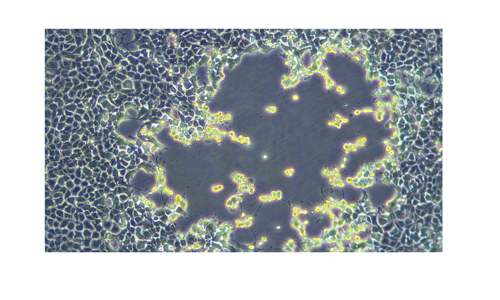 MPOX Image 4.1